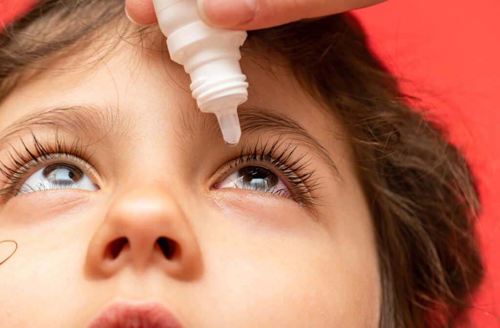 A close up of a young boy having atropine eye drops in his eye as a method of myopia control.