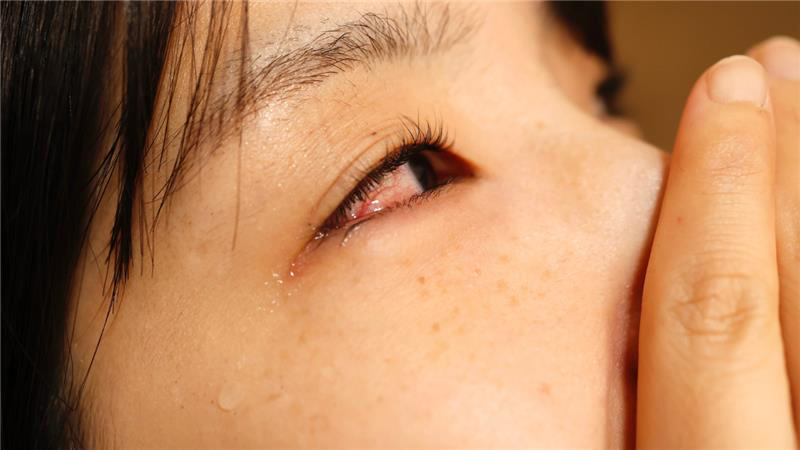 Dry Eye vs. Eye Infection: How to Tell the Difference