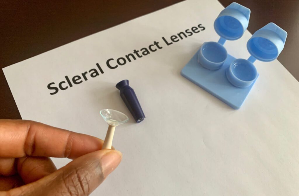 What Are the Best Contact Lenses for Dry Eye?